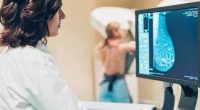 El miedo a la recaída marca futuro de pacientes con cáncer – La Voz del Altiplano