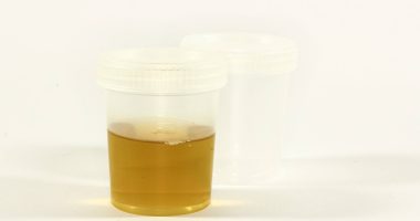 ¿síntoma de cáncer y riesgo mortal? – La Voz del Altiplano