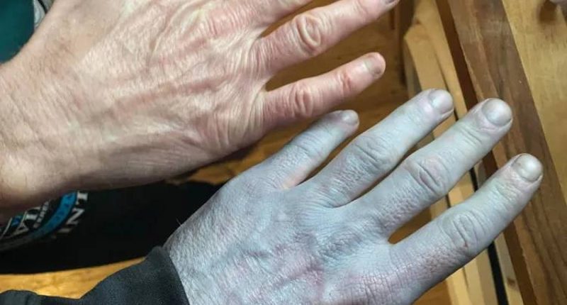 sorprende a médicos y pacientes – La Voz del Altiplano