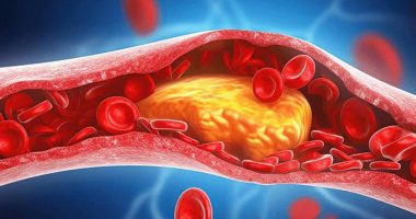 Estrategias naturales para bajar triglicéridos naturalmente – La Voz del Altiplano